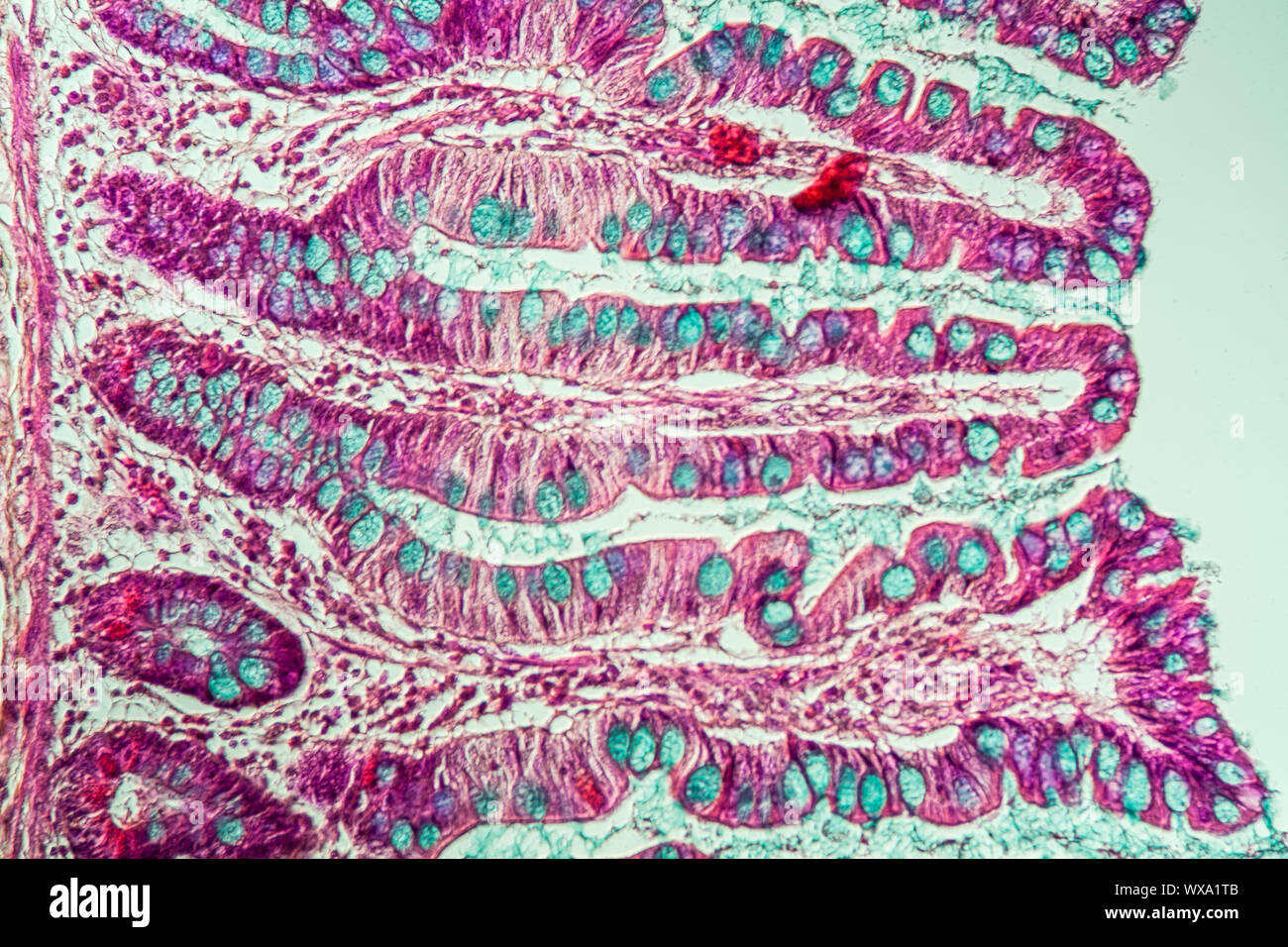 Small intestine with intestinal villi under the microscope 200x Stock Photo  - Alamy
