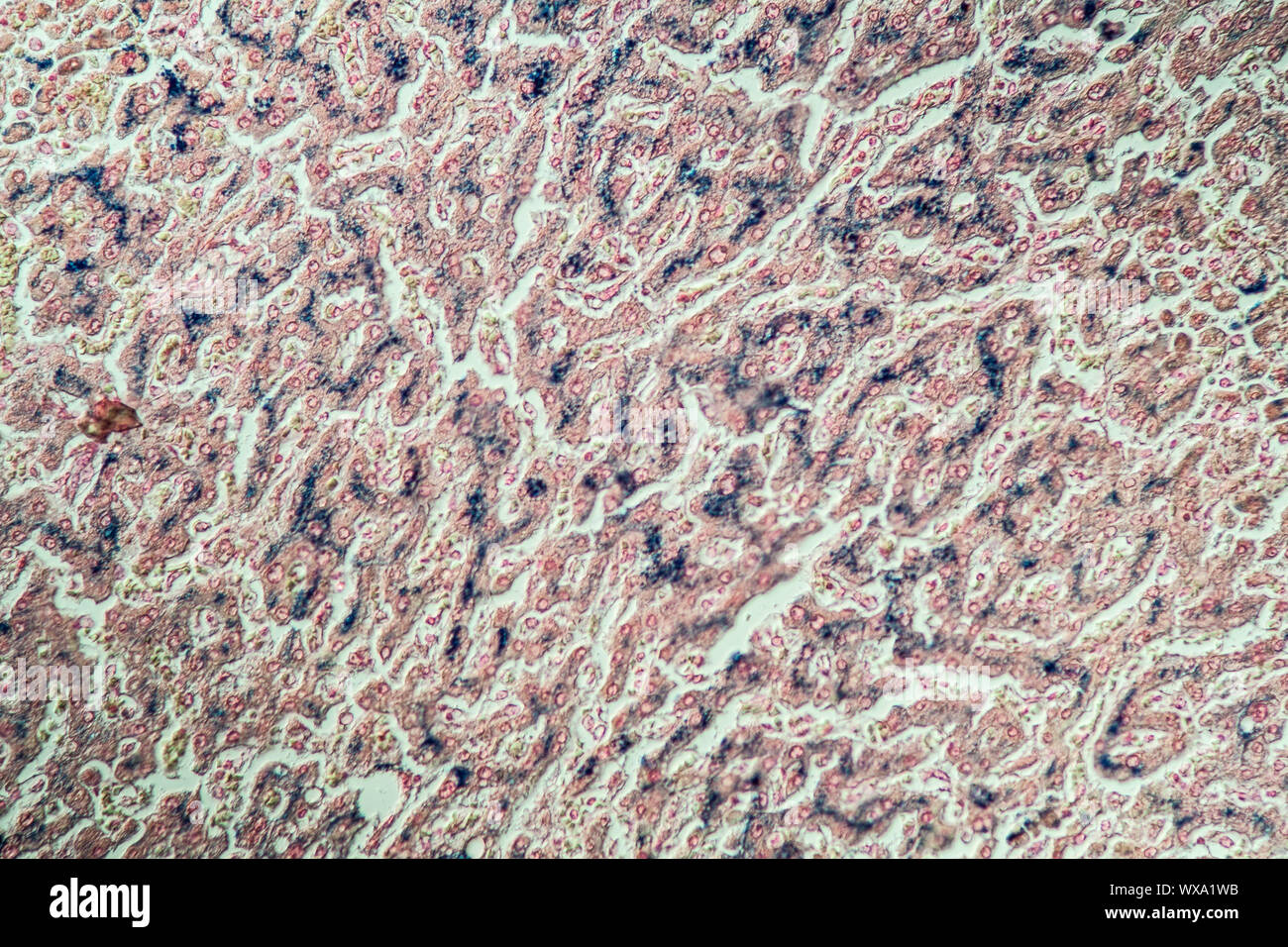 Hemosiderosis liver under the microscope 100x Stock Photo