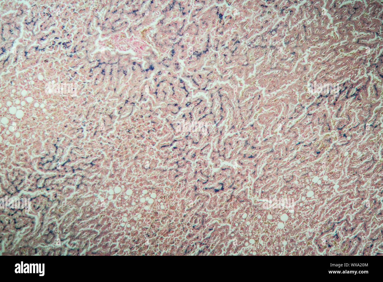 Hemosiderosis liver under the microscope 100x Stock Photo