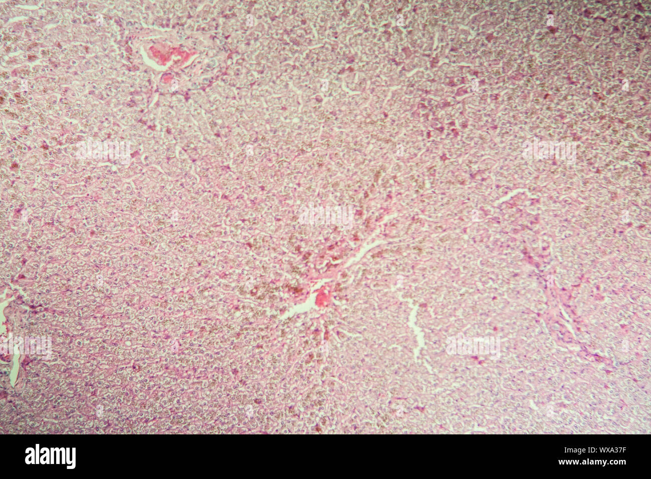 Dubin Johnson liver disease in the microscope 100x Stock Photo Alamy