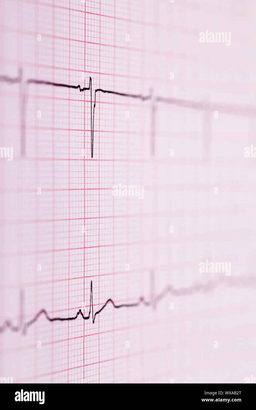 Closeup view of ECG graph. Electrocardiograph Stock Photo Alamy