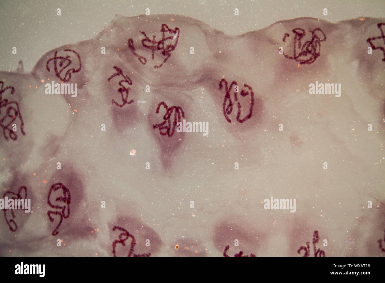 Giant chromosomes under the microscope 400x Stock Photo