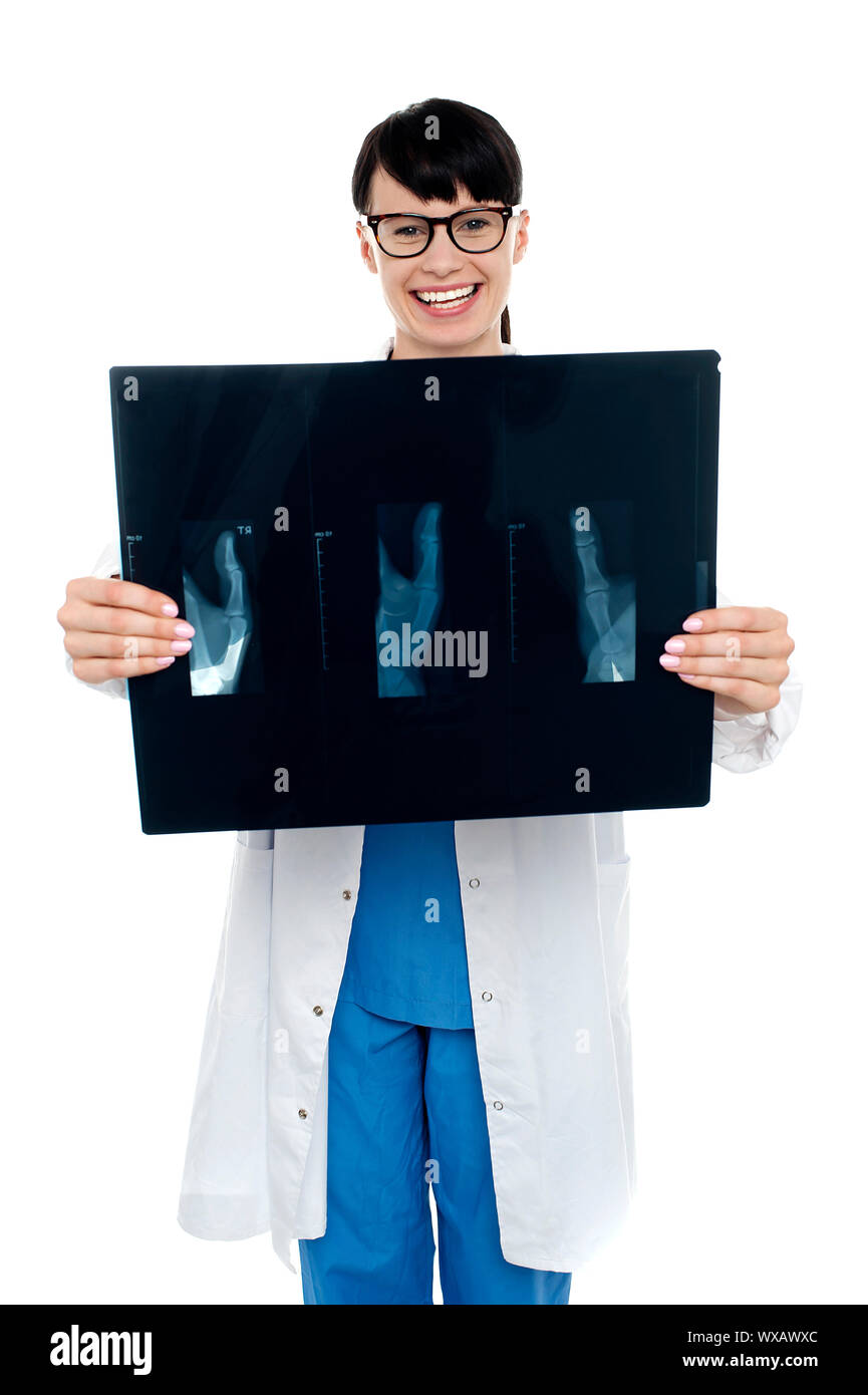 Displaying x ray Cut Out Stock Images & Pictures - Alamy