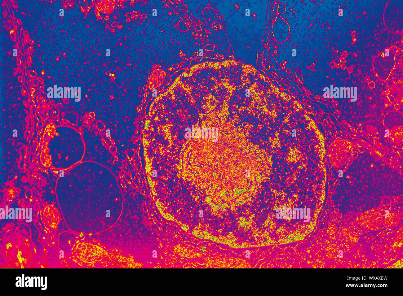 Nucleus under the electron microscope 10,000x Stock Photo