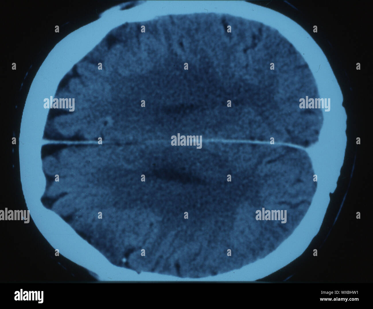 Computer tomography of the human head Stock Photo