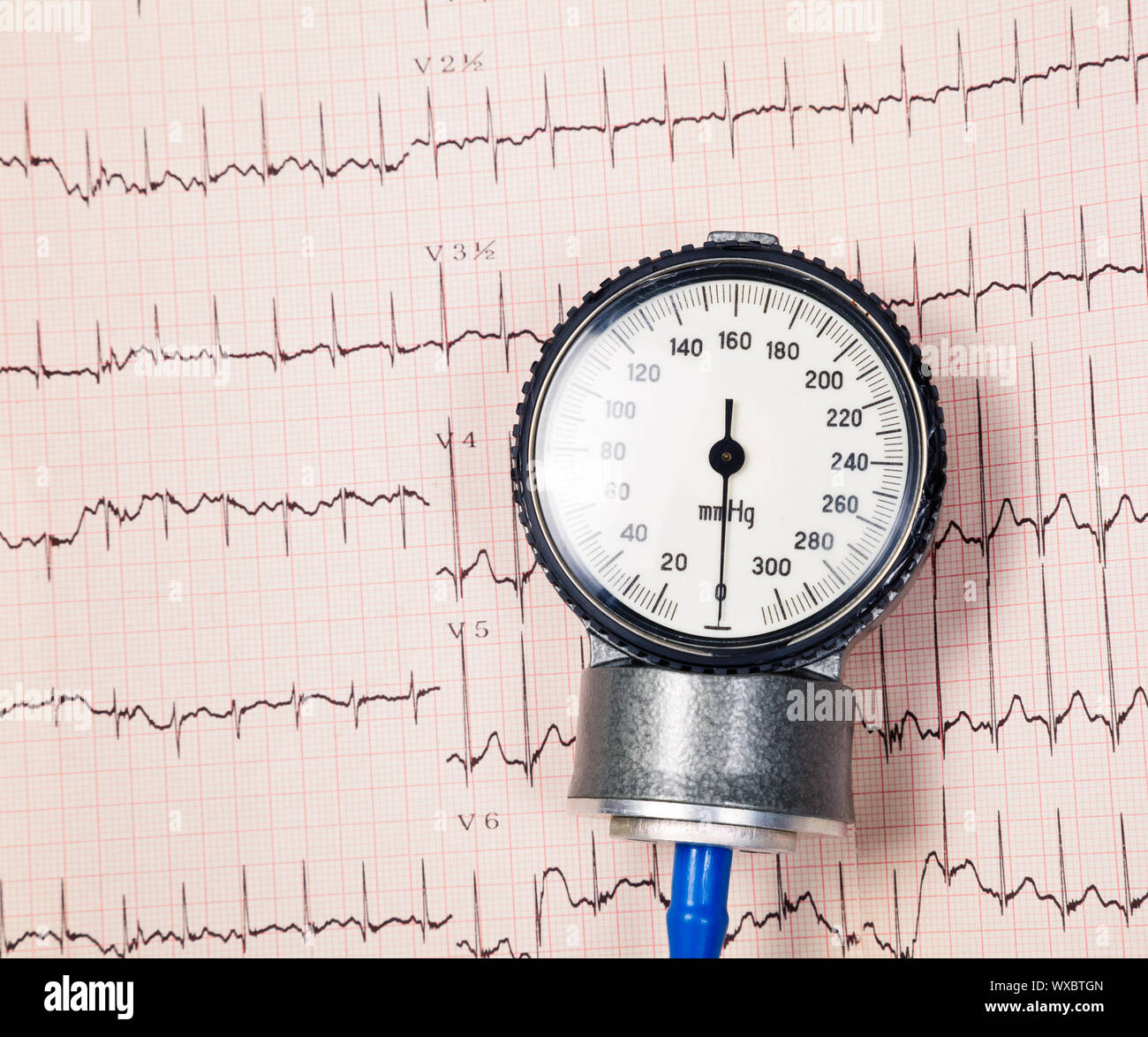 Simple block scheme of blood pressure monitor  Download Scientific Diagram