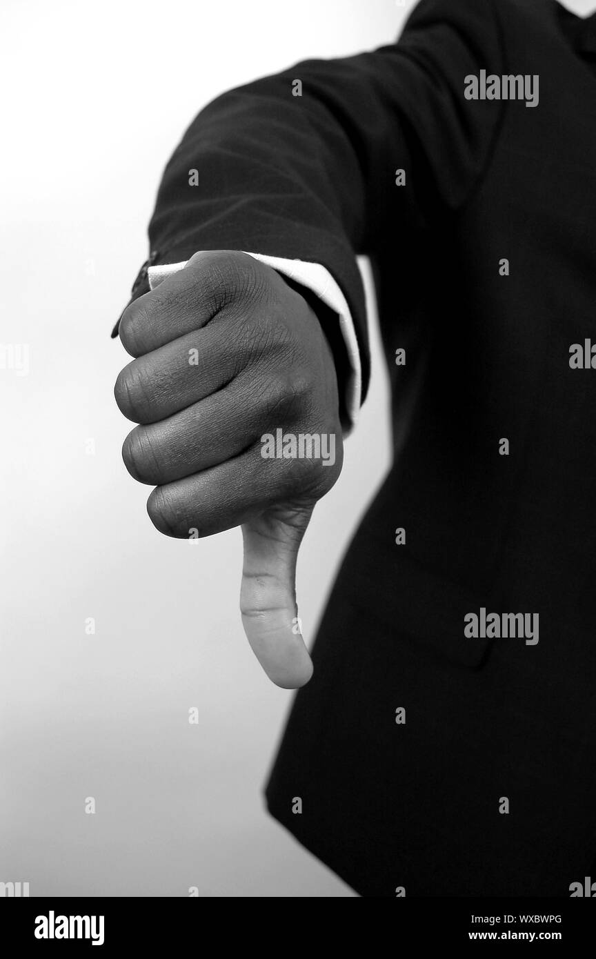 This is an image of a hand pointing downwards, impling bad business ...