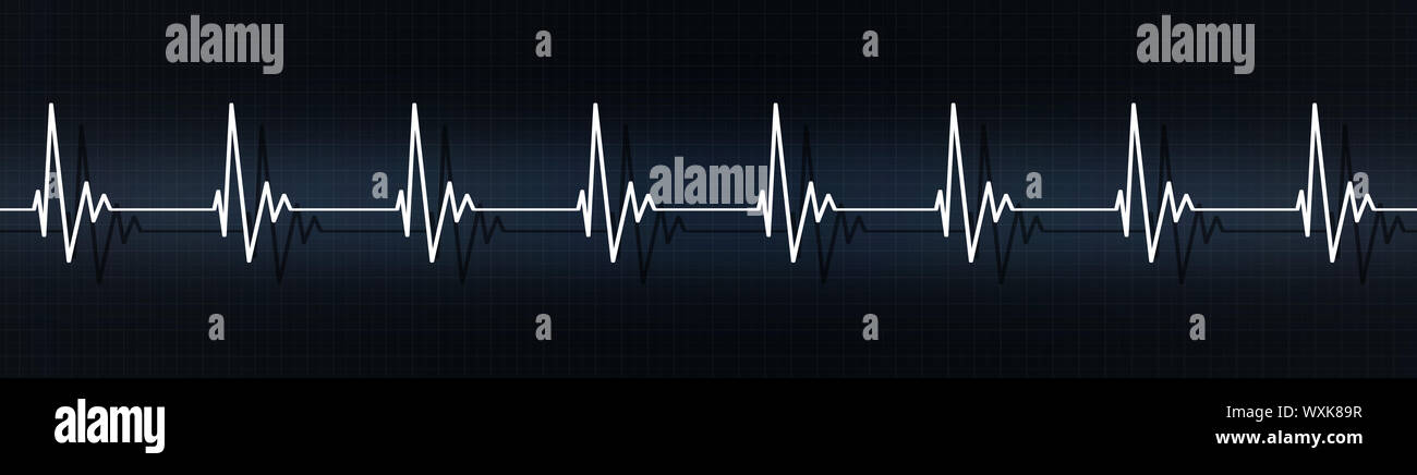 medical banner illustrating. normal heart rateon ecg Stock Photo