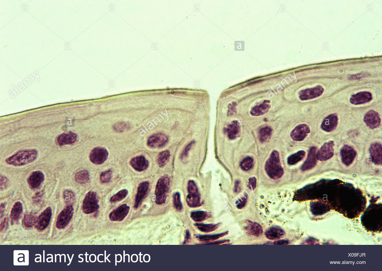 Skin Membrane High Resolution Stock Photography and Images - Alamy