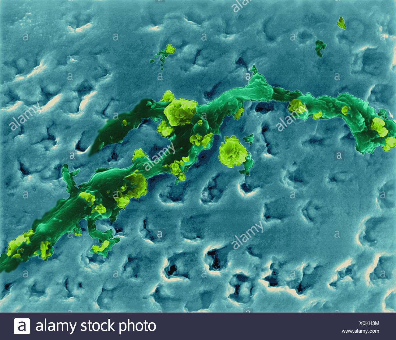 Bacterial Plaque Stock Photos & Bacterial Plaque Stock Images Alamy