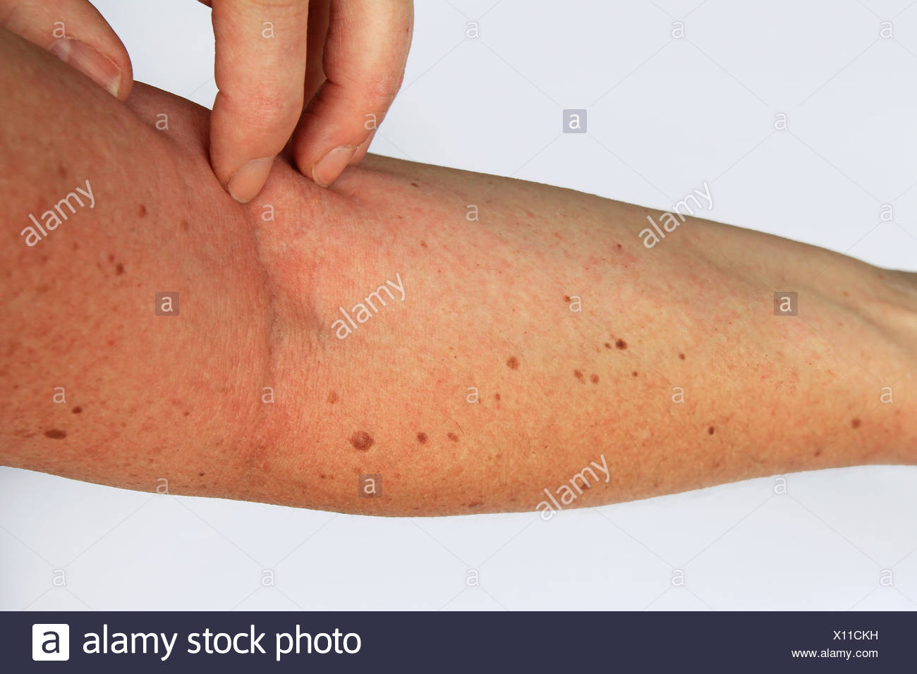 Vesication Vesication High Resolution Stock Photography and Images - Alamy