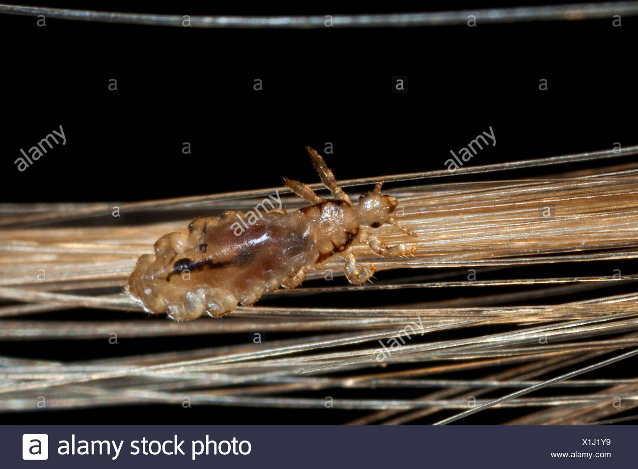 Louse In Human Hair High Resolution Stock Photography and Images Alamy