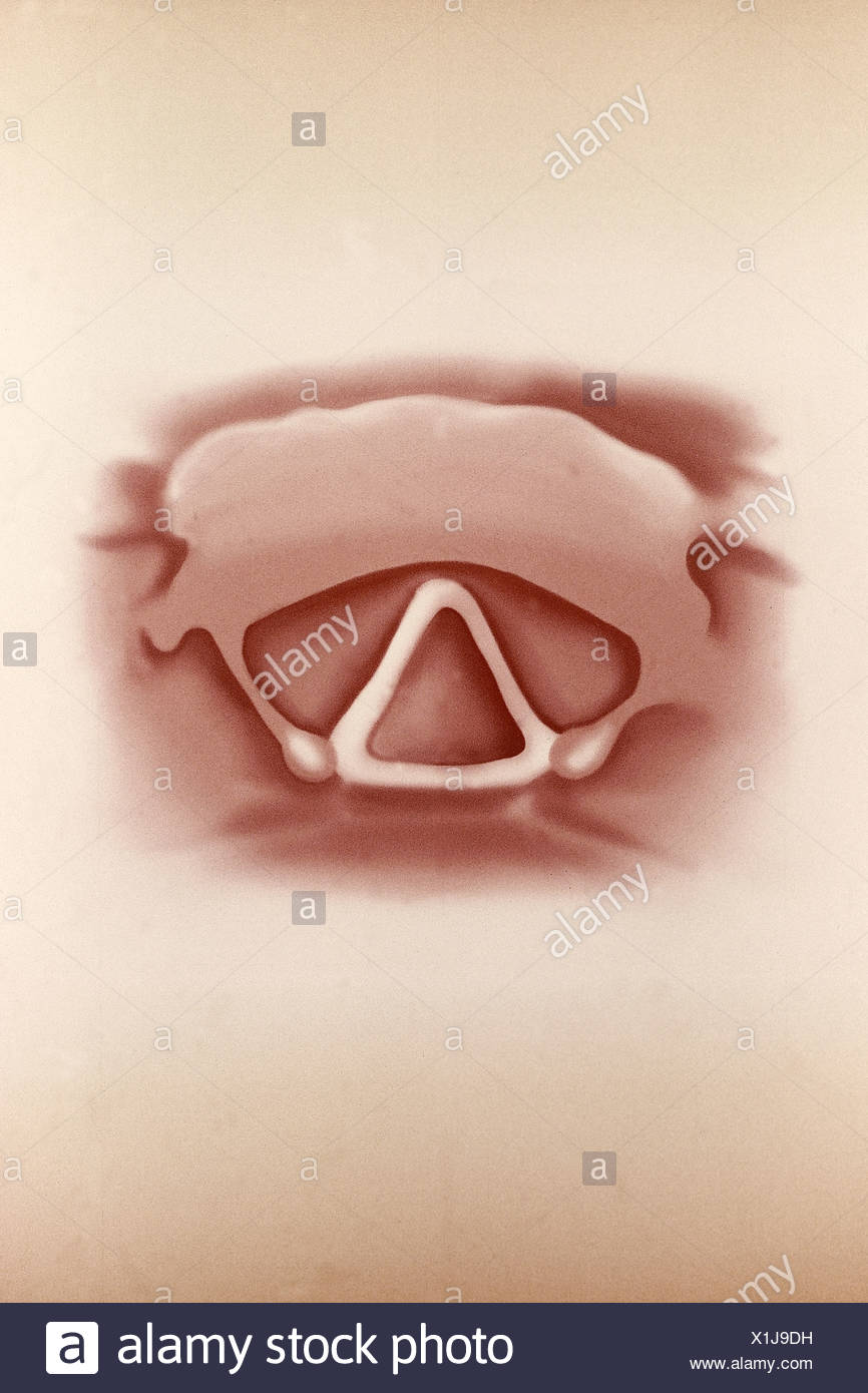 Vocal Cords Drawing High Resolution Stock Photography and Images Alamy