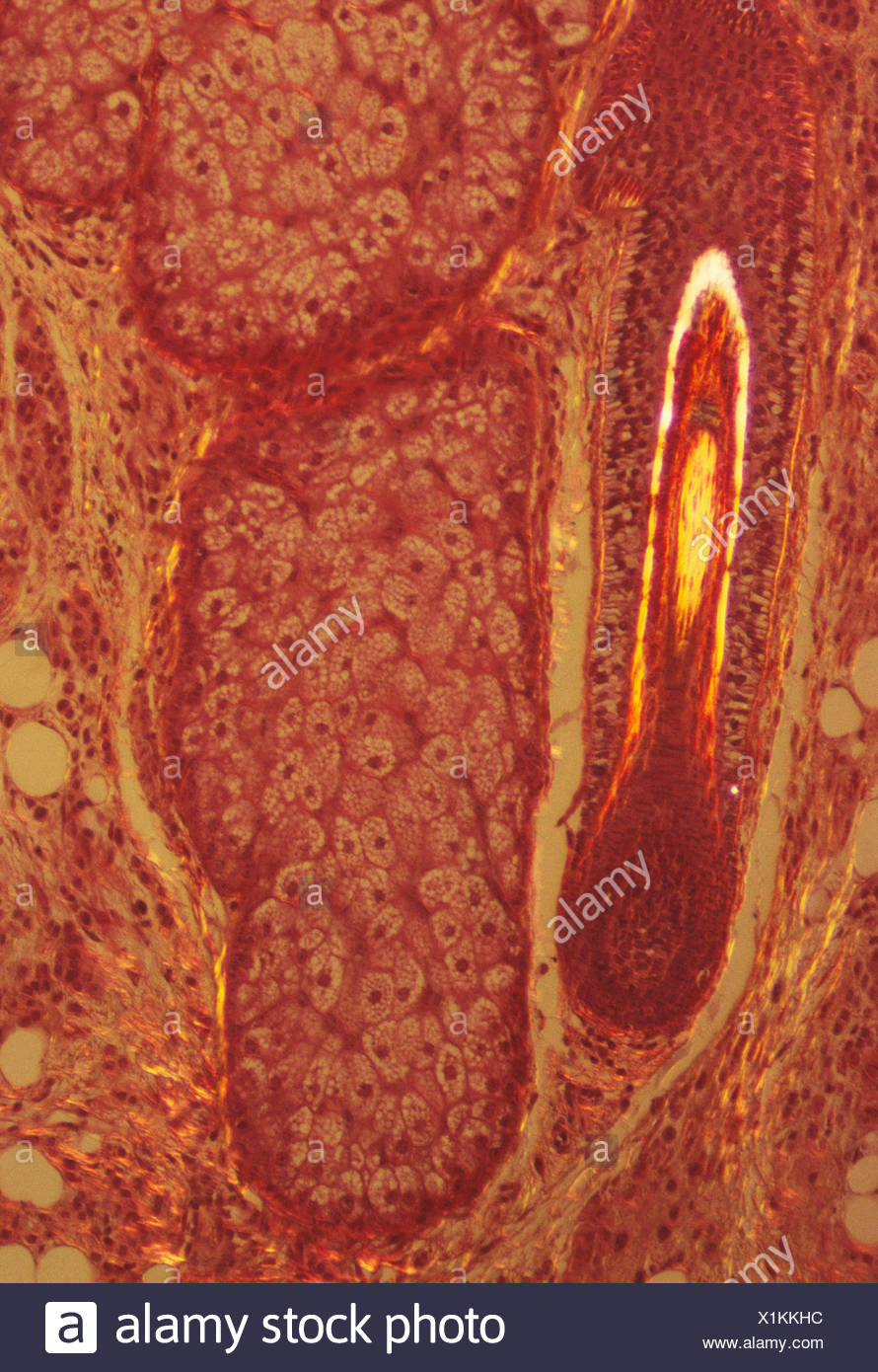 Hair Follicle Microscope High Resolution Stock Photography and Images