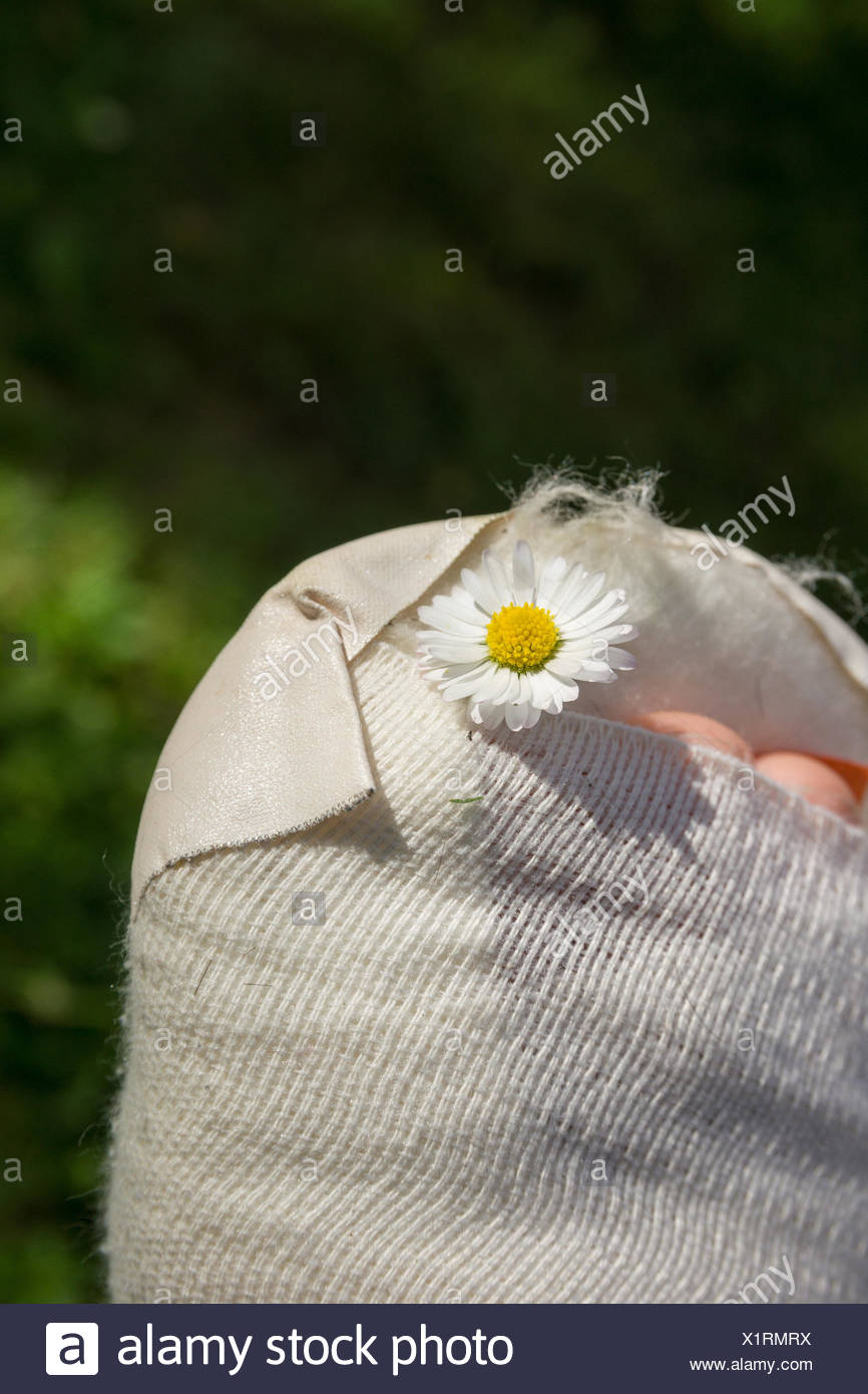 Gipsfuß eines Kindes Stock Photo