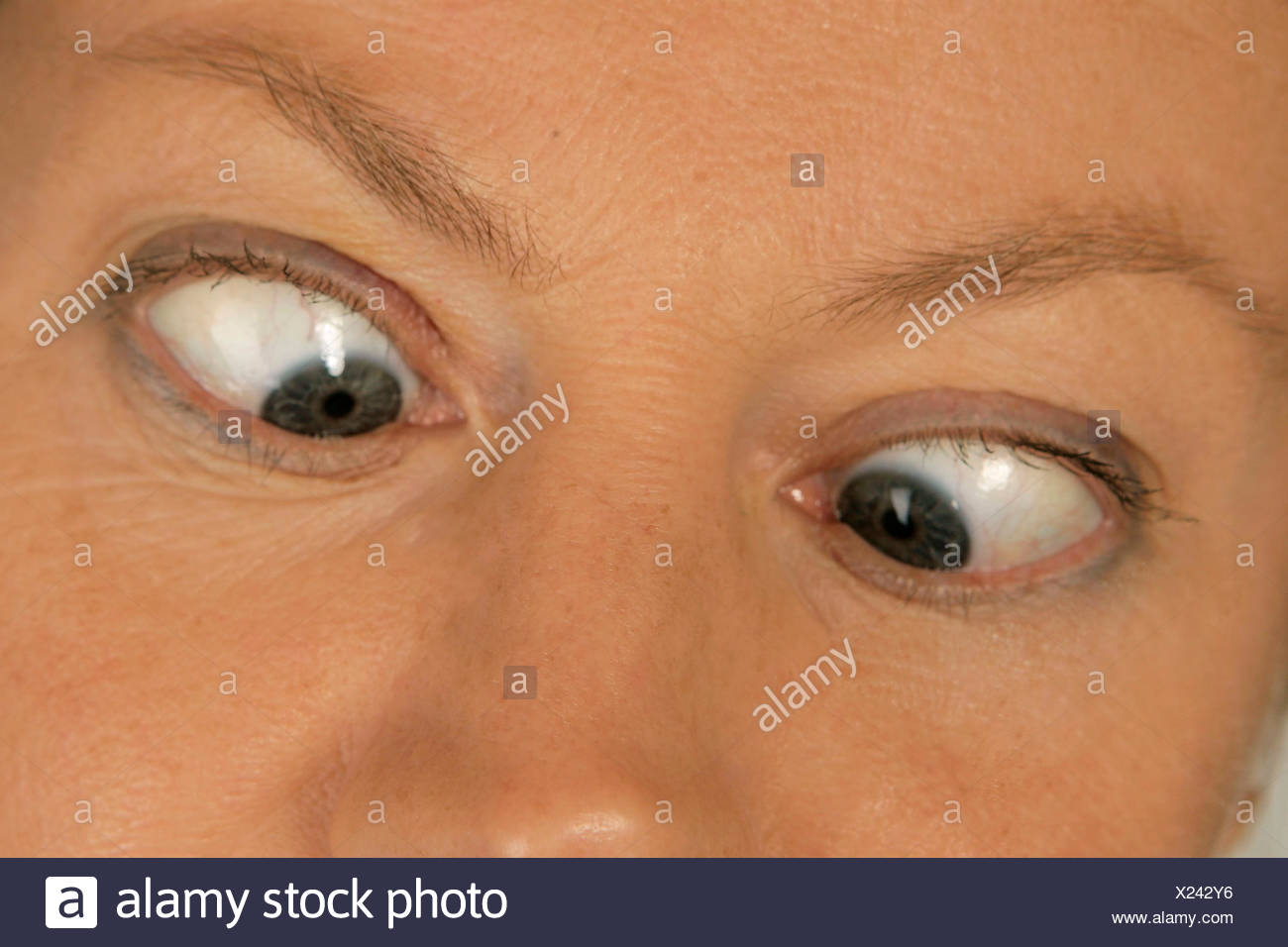 Cross Eyed Woman High Resolution Stock Photography and Images Alamy
