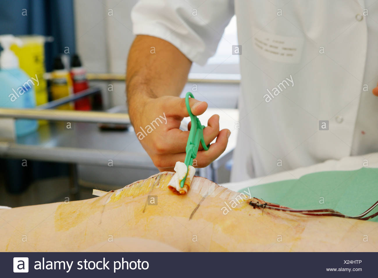 Bed Sores High Resolution Stock Photography and Images Alamy