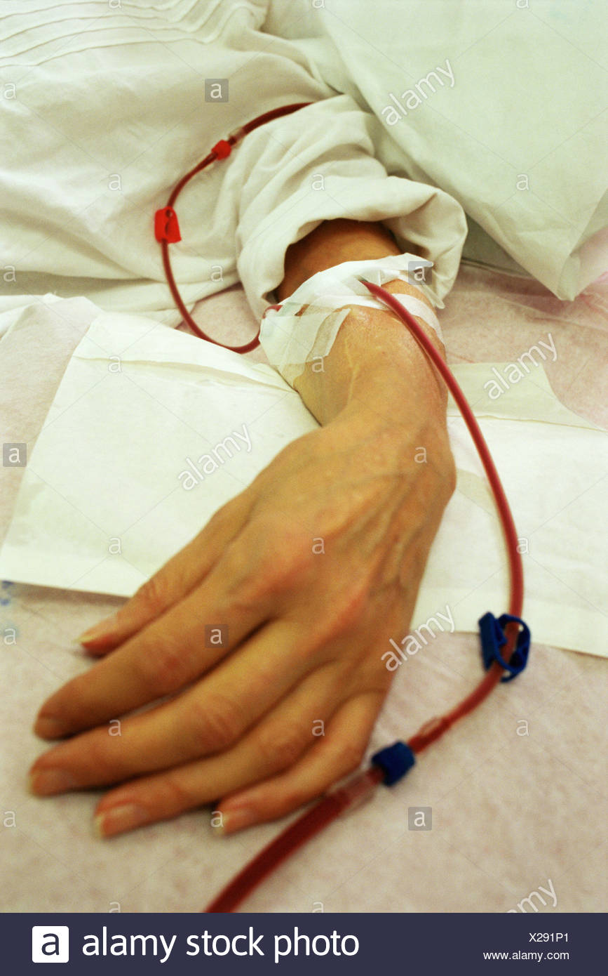 Hemodialysis Arm Stock Photos & Hemodialysis Arm Stock Images Alamy
