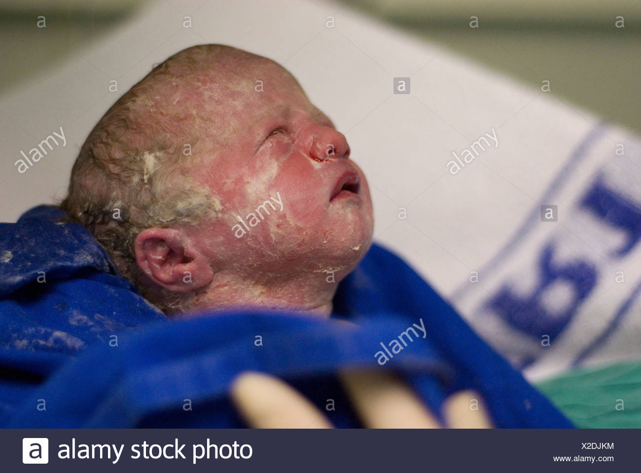 Amniotic Fluid High Resolution Stock Photography and Images Alamy