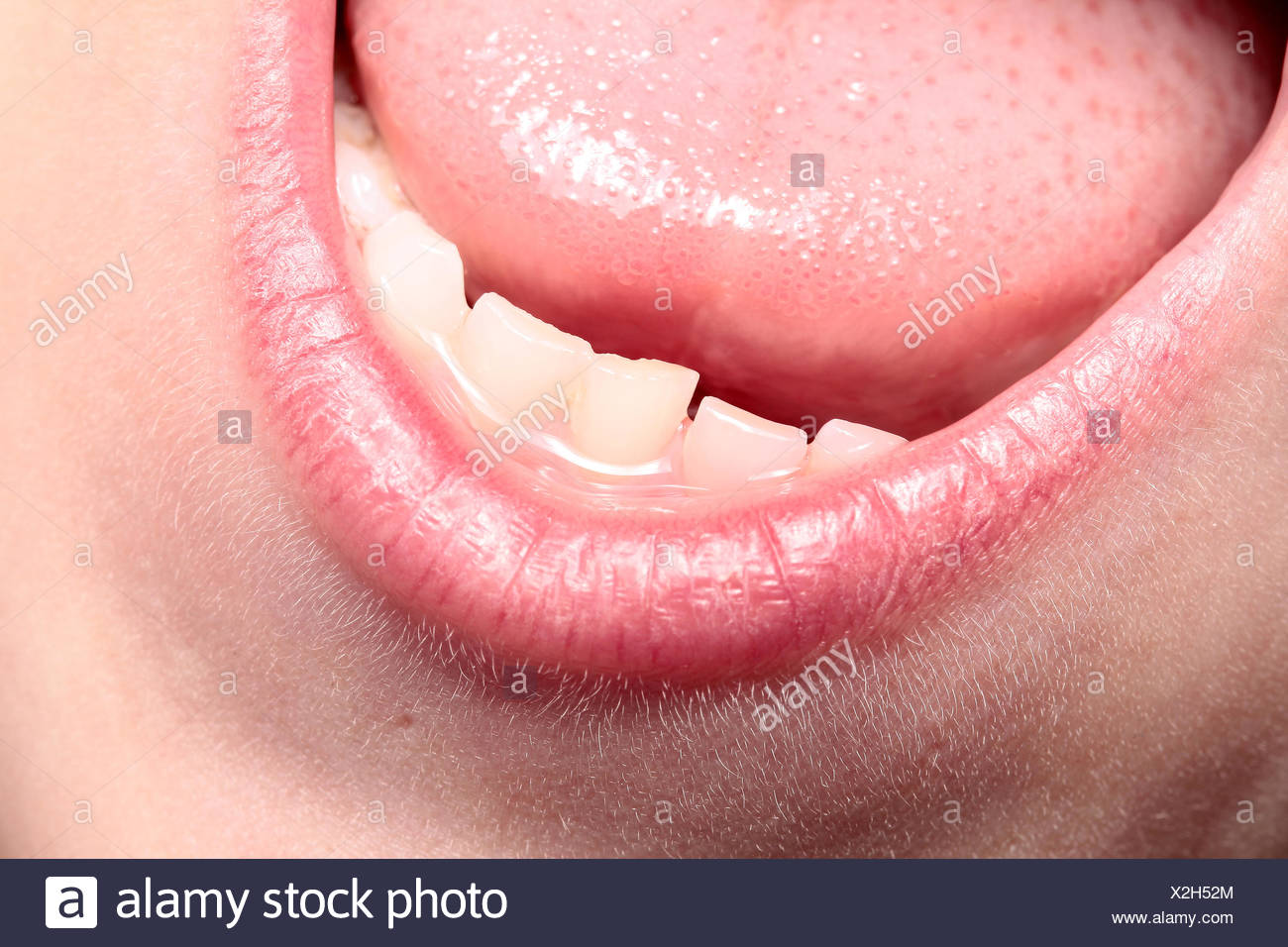 milk teeth Stock Photo