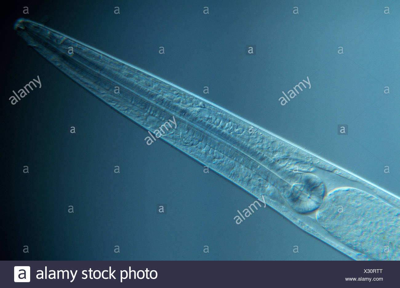 Triangular Roundworm Roundworm Parasite High Resolution Stock Photography and Images - Alamy