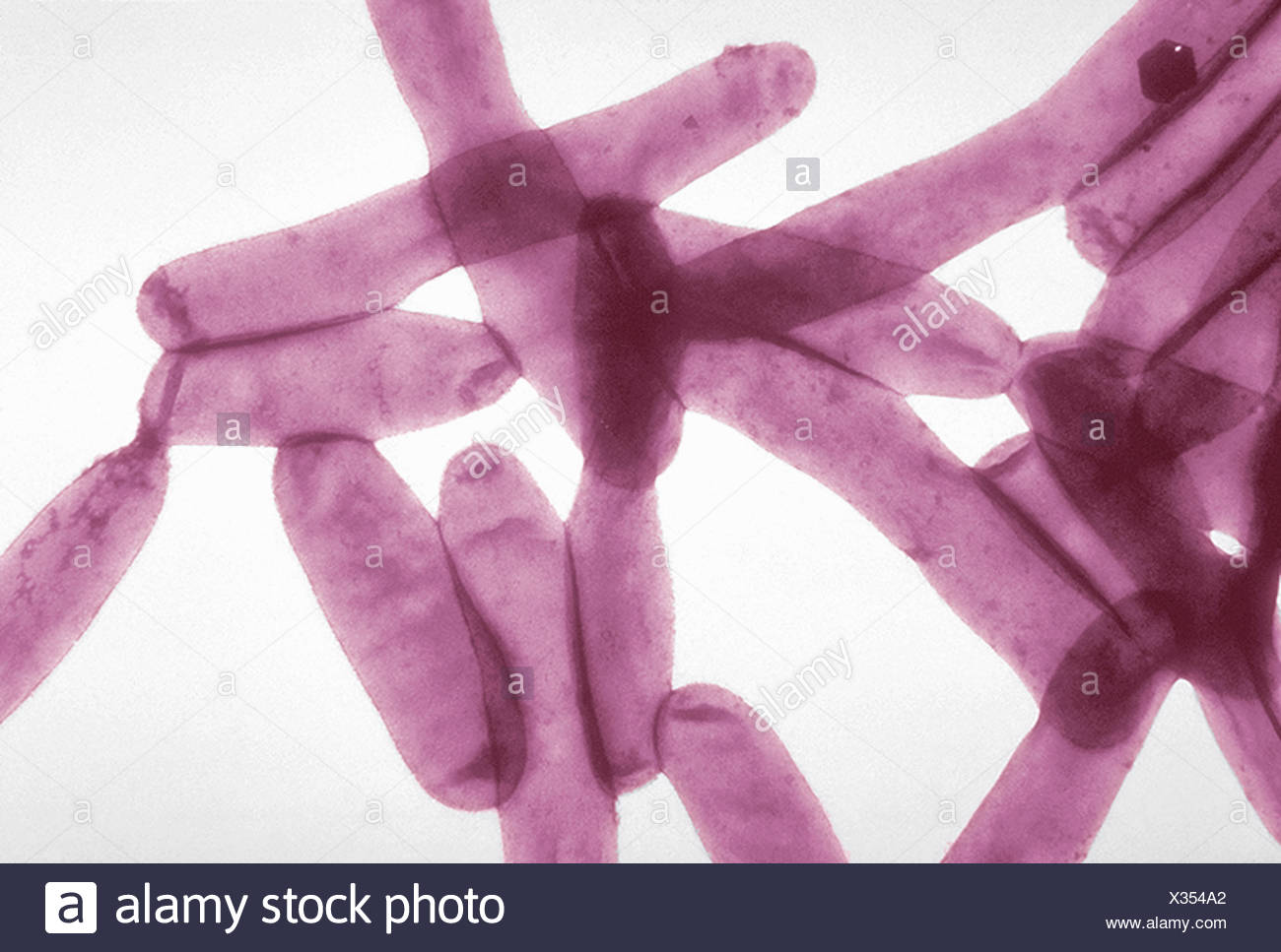 Legionella Bacteria Stock Photos & Legionella Bacteria Stock Images Alamy