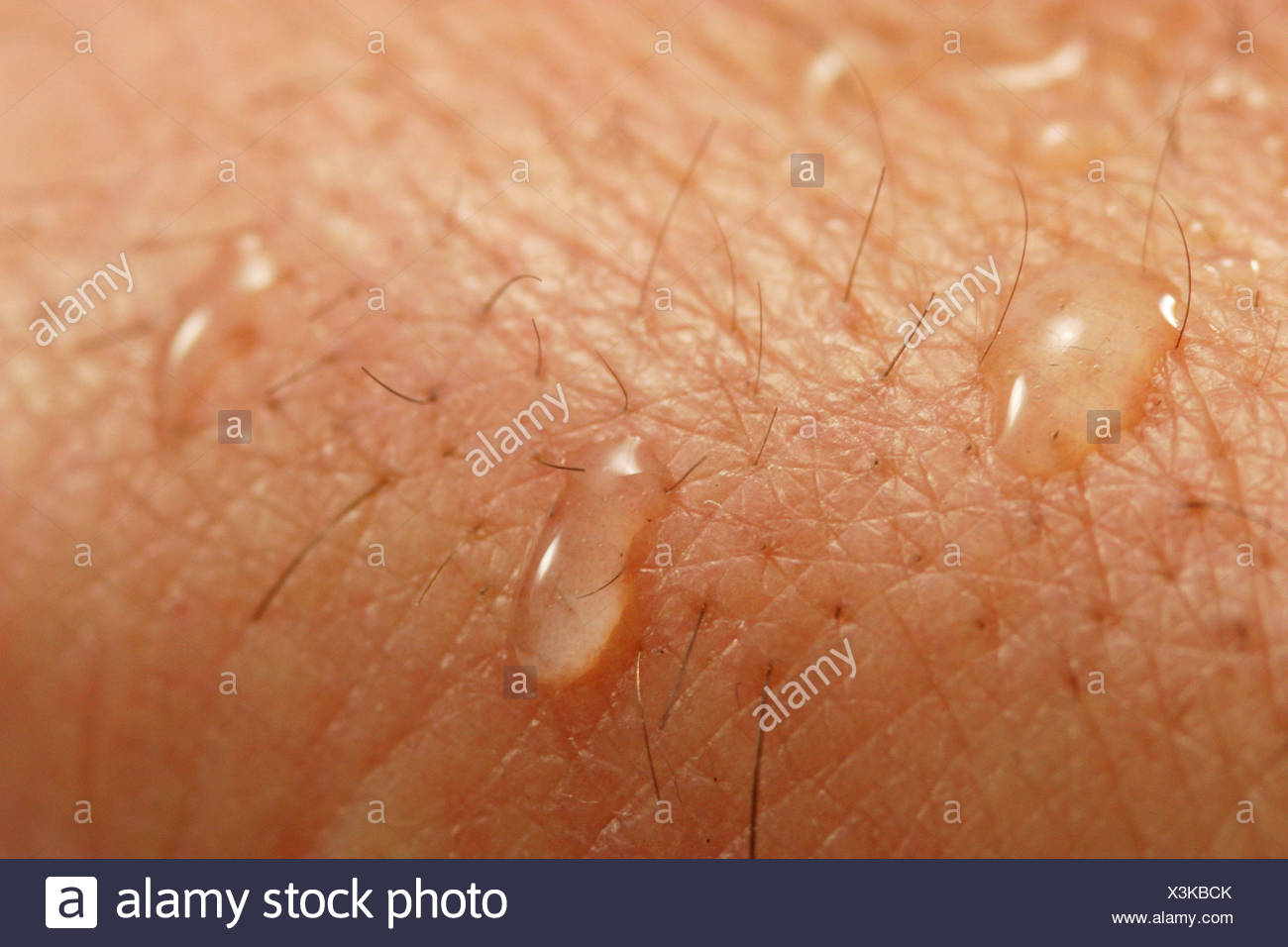 pores human stock photos pores human stock images alamy pores human stock photos pores human stock images alamy pores human stock photos pores human stock images alamy pores human stock photos pores human stock images alamy