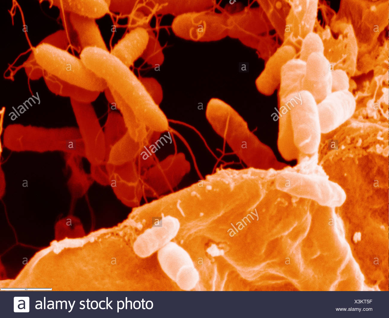 Agrobacterium Tumefaciens High Resolution Stock Photography and Images ...