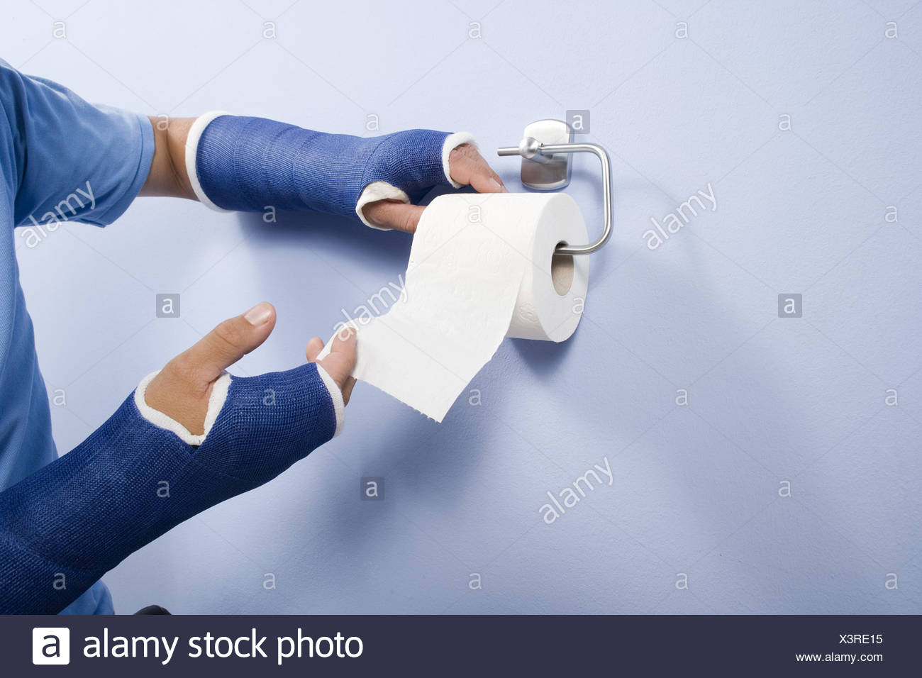 Both Arms Casts High Resolution Stock Photography and Images Alamy