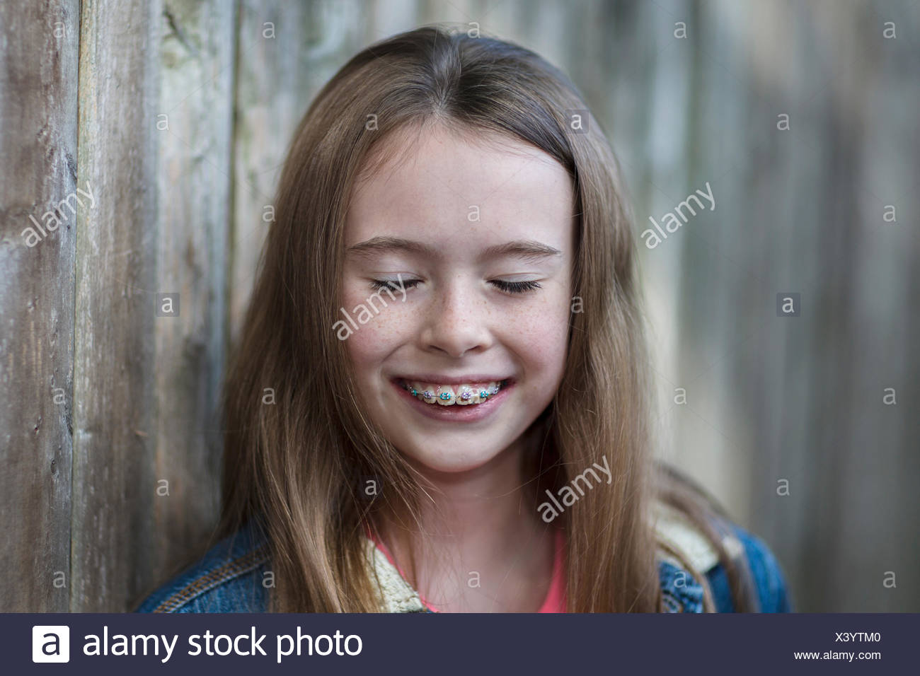 Portrait Of Girl With Dental Brace Eyes Closed Smiling Stock