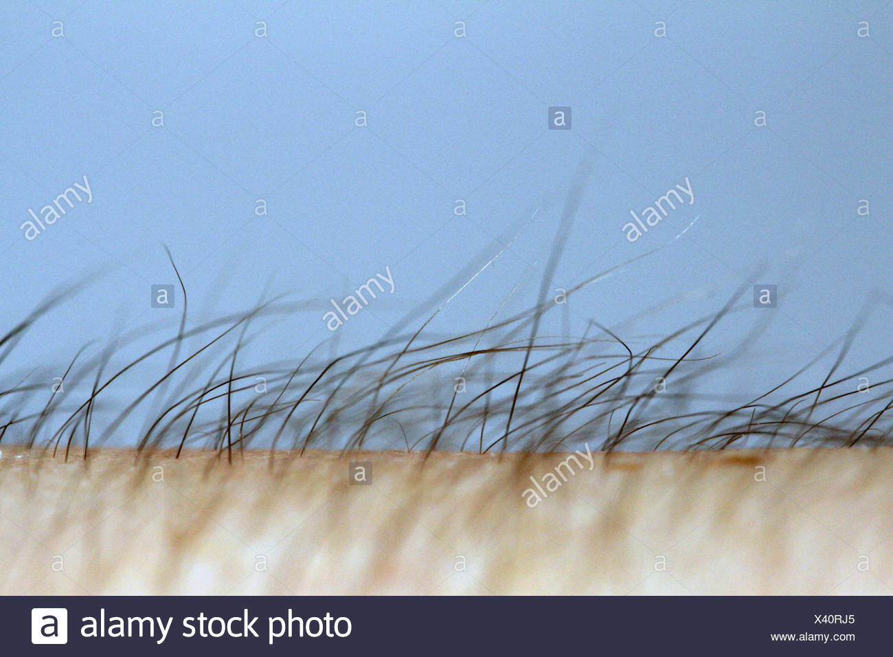 Hairs Standing Up On A Man S Arm Stock Photo Alamy