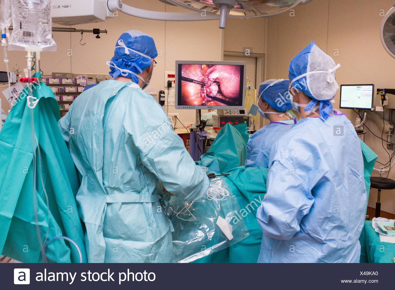 Endometriosis Laparoscopy Surgery High Resolution Stock Photography and