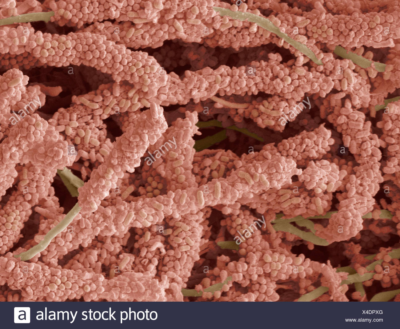 Plaque Forming Stock Photos & Plaque Forming Stock Images Alamy