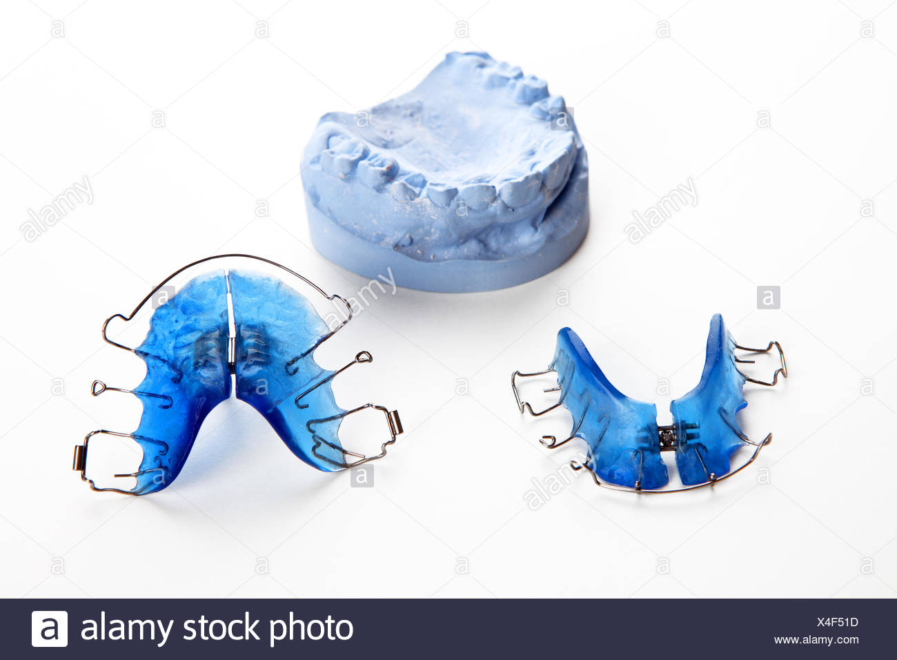 Dental brace Stock Photo