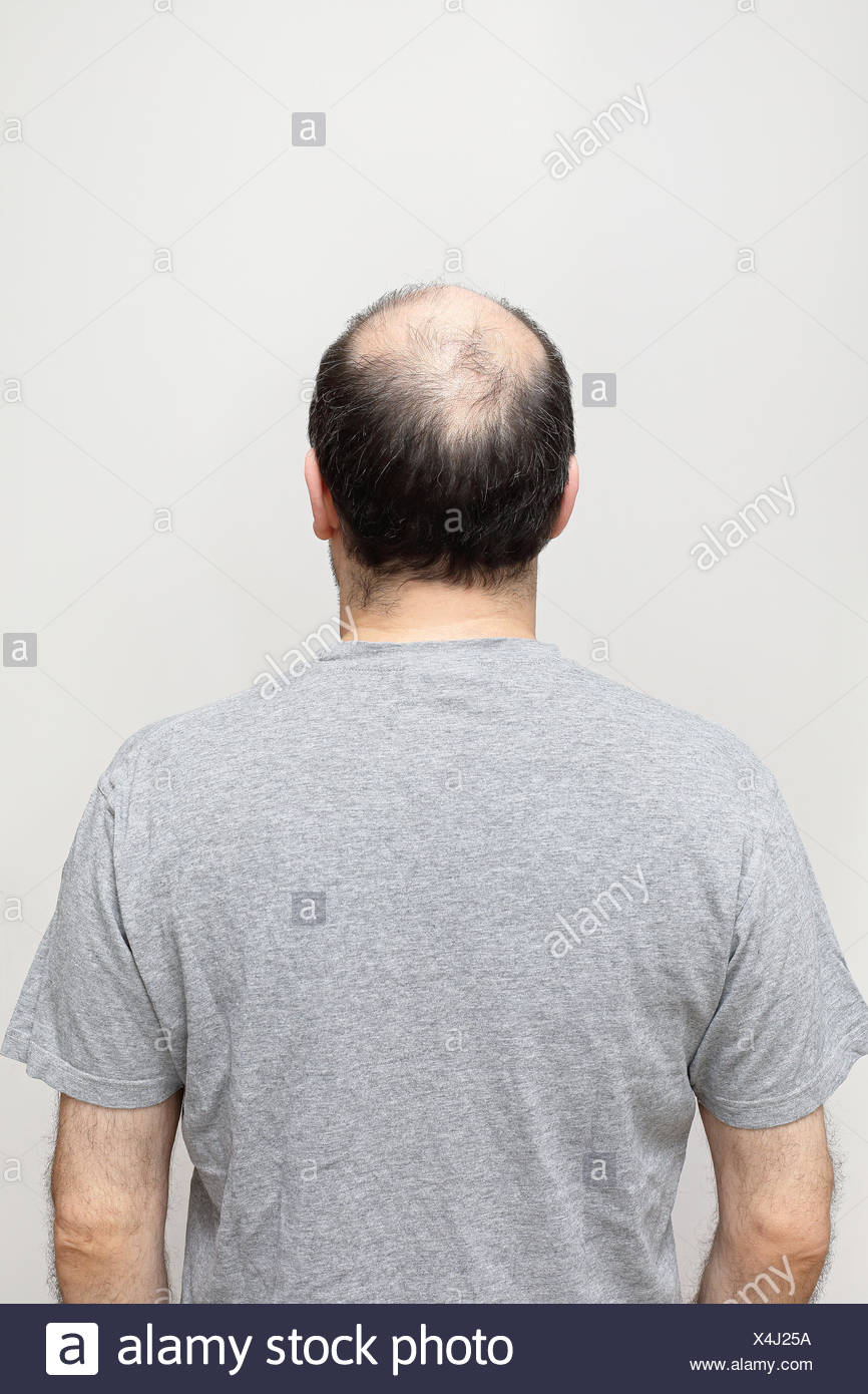 Bald Head Back Of High Resolution Stock Photography and Images - Alamy
