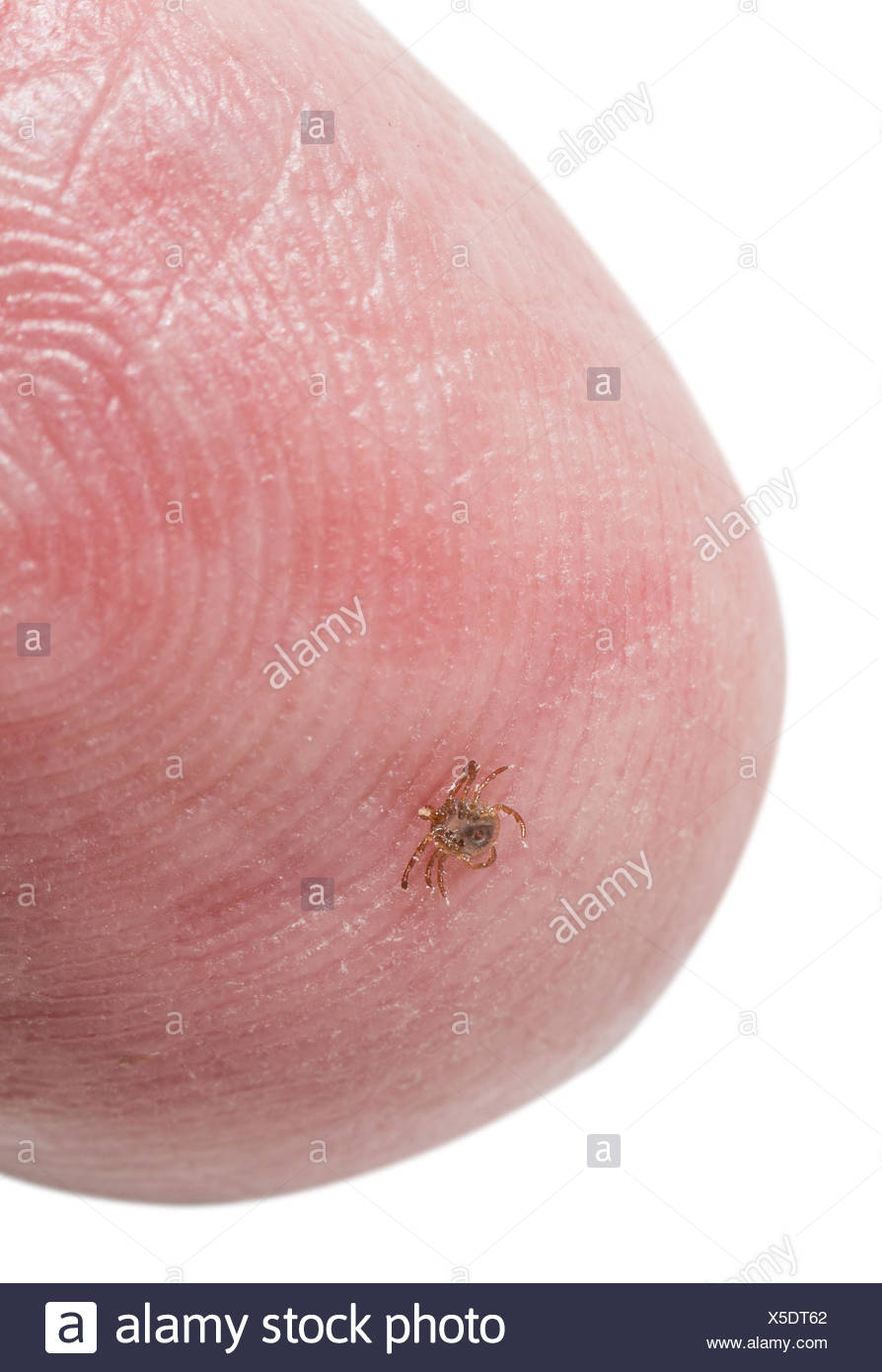 Deer Tick Stock Photos & Deer Tick Stock Images - Alamy