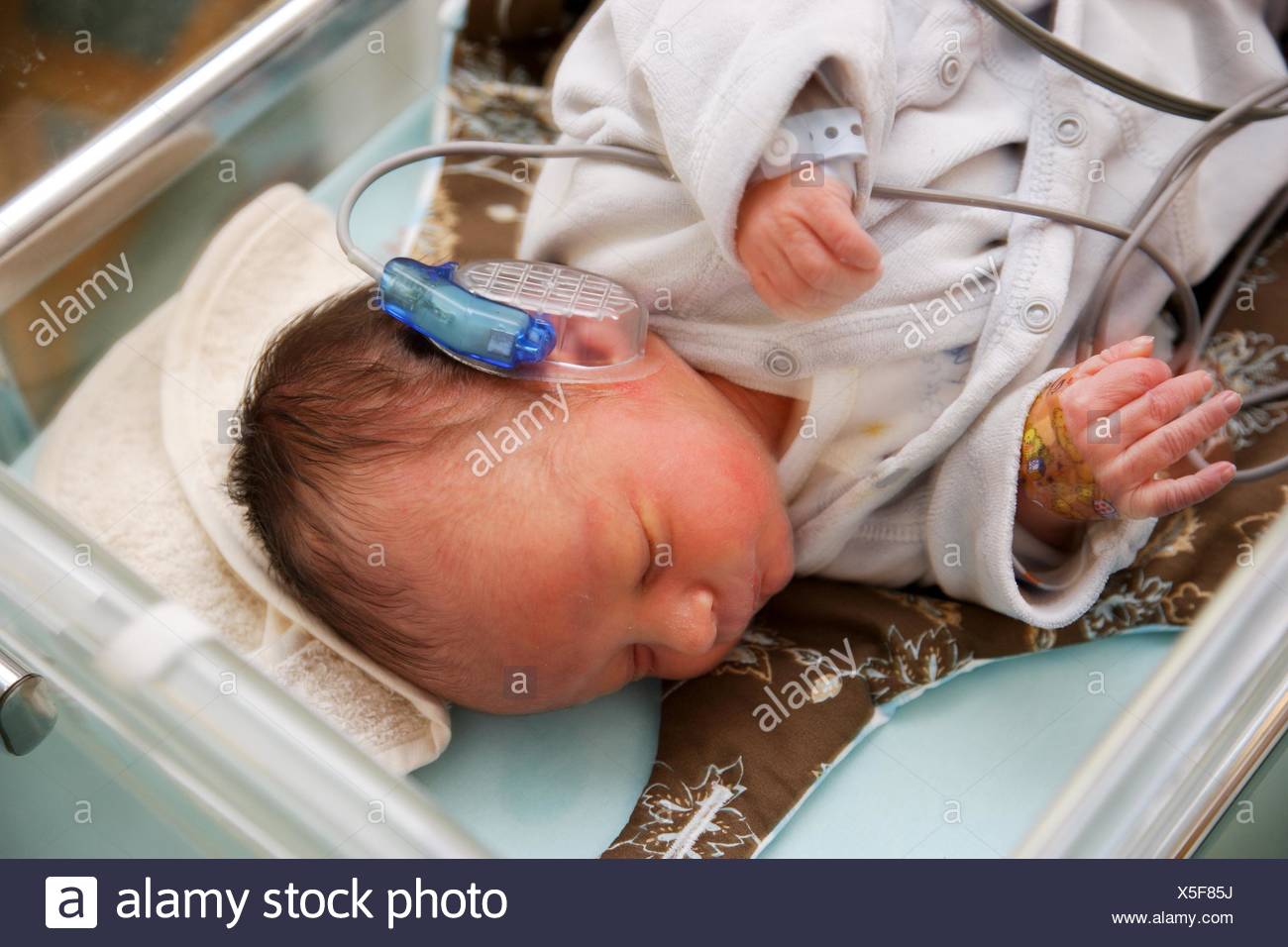 2 Day Old Baby Undergoing Deafness Screening Test With The Method Of The Auditory Evoked Potentials Aep Which Analyzes The Stock Photo Alamy 2 Day Old Baby Undergoing Deafness Screening Test With The Method Of The Auditory Evoked Potentials Aep Which Analyzes The Stock Photo Alamy