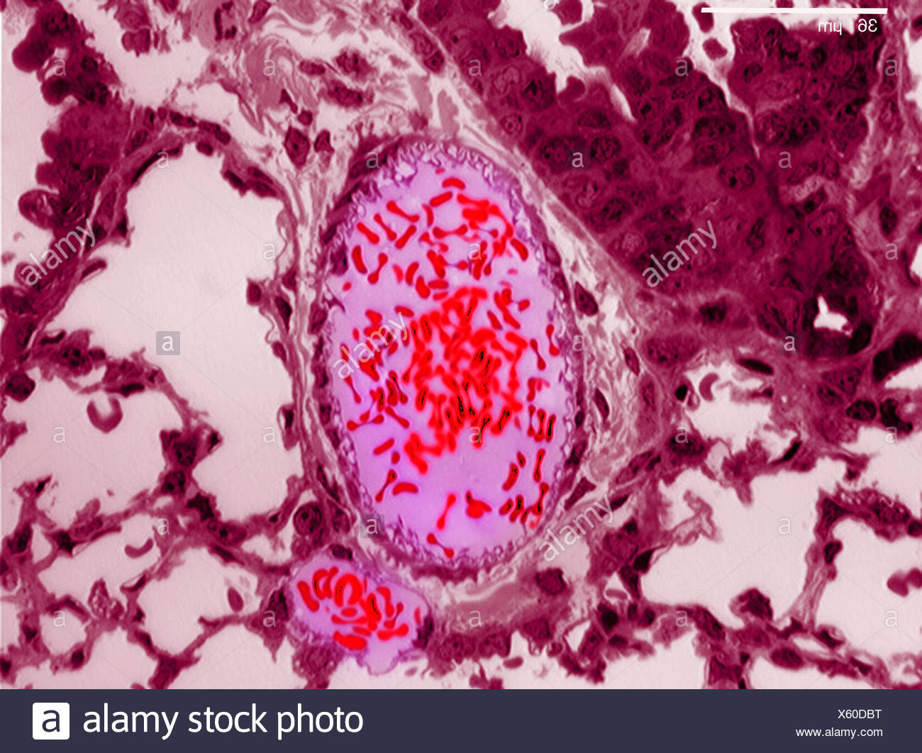 Lung Epithelium High Resolution Stock Photography and Images - Alamy