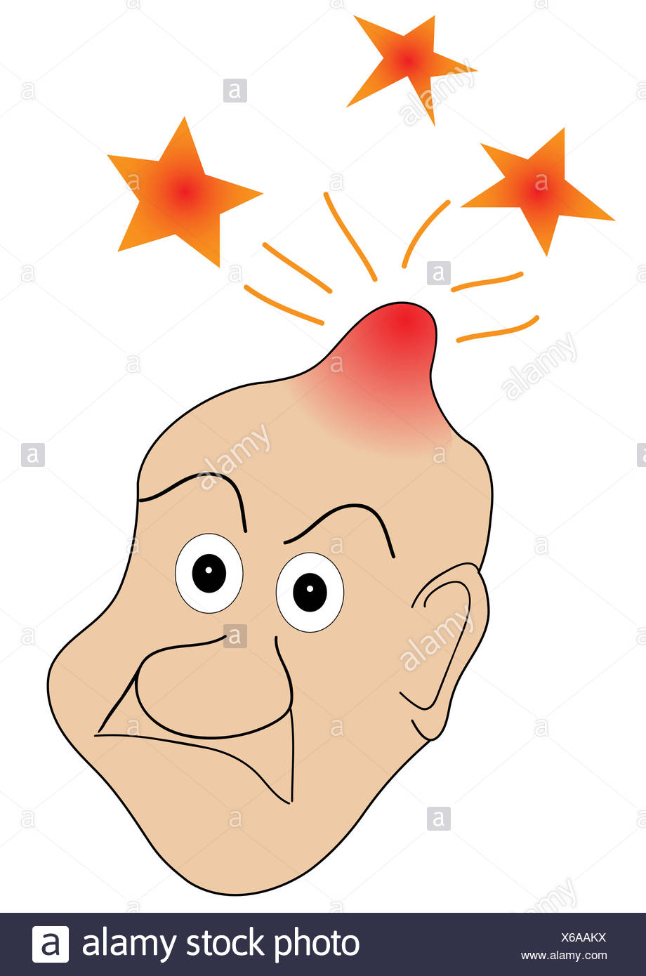 Bump Head High Resolution Stock Photography and Images - Alamy