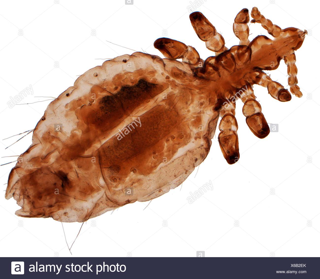 Human Head Louse Light Microraph Lm 0f Pediculus Humanus