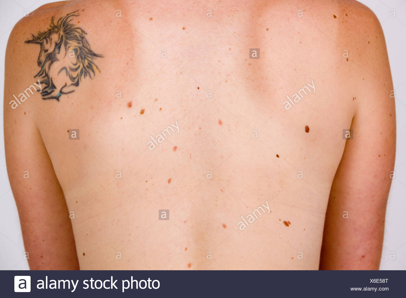 Moles Skin High Resolution Stock Photography and Images - Alamy