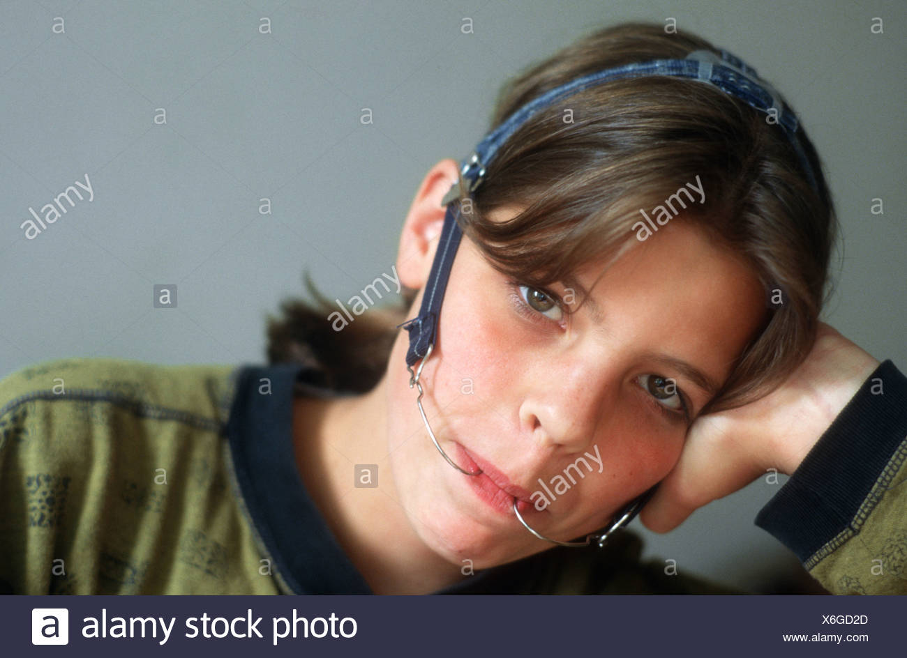 Retainer Retainer Orthodontic Stock Photos & Retainer Retainer