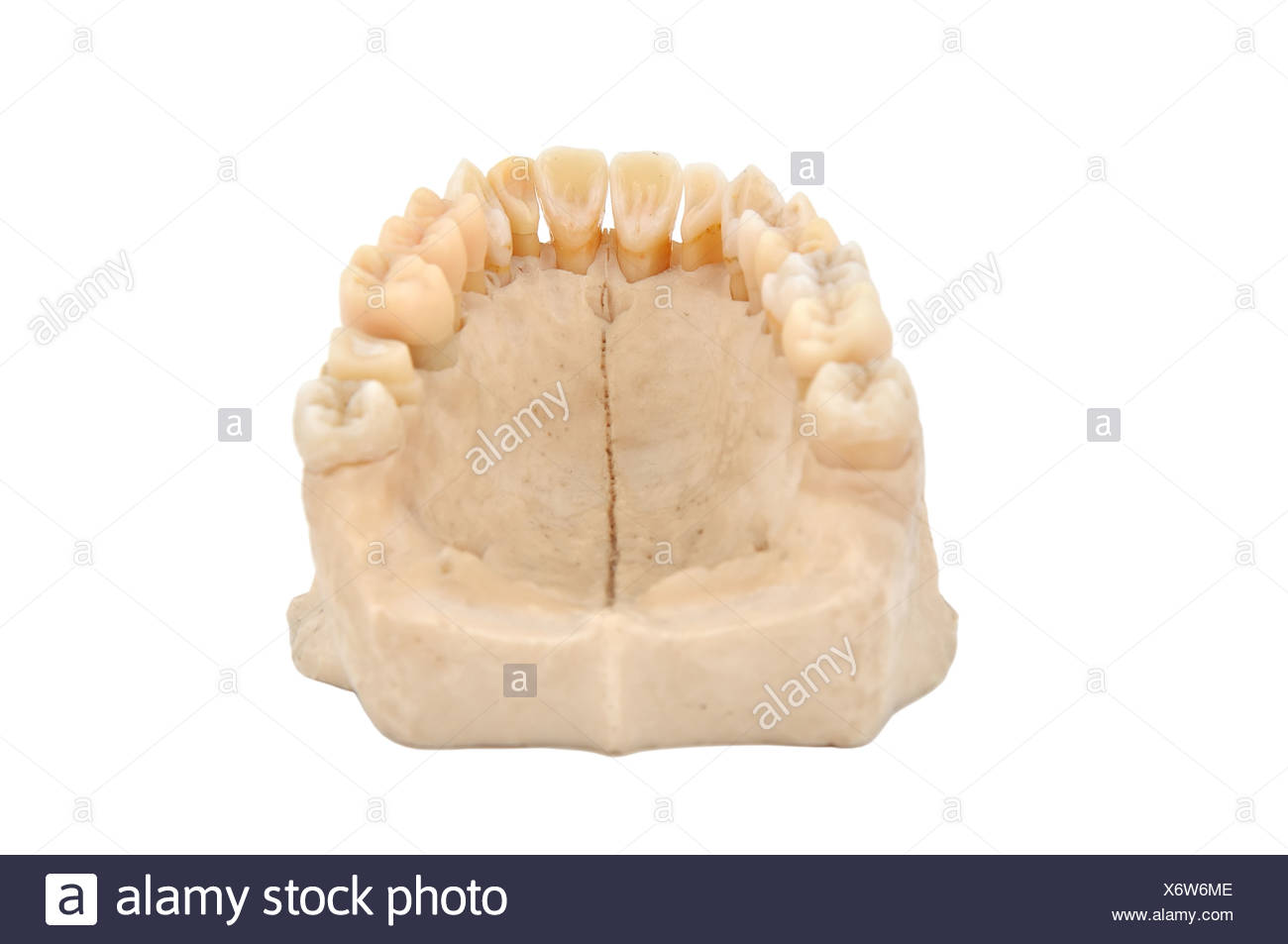 Upper Jaw Bone Stock Photos & Upper Jaw Bone Stock Images - Alamy