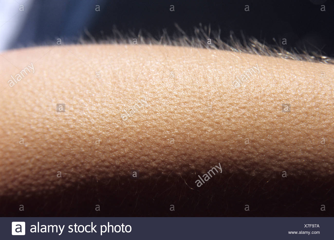 Goose Pimples High Resolution Stock Photography and Images Alamy