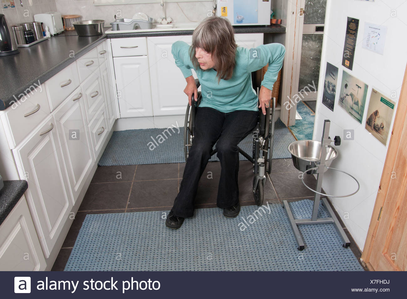 Woman Spina Bifida In Wheelchair High Resolution Stock Photography and ...