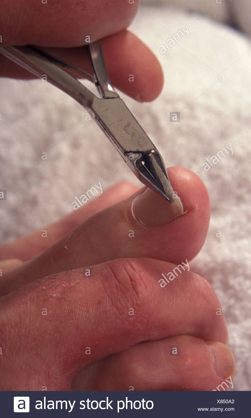 Cutting Toe Nails Stock Photos &amp; Cutting Toe Nails Stock Images - Alamy