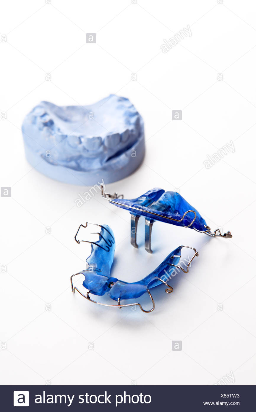 Dental brace Stock Photo