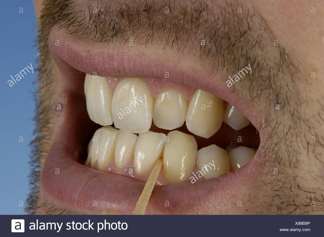 toothpick teeth