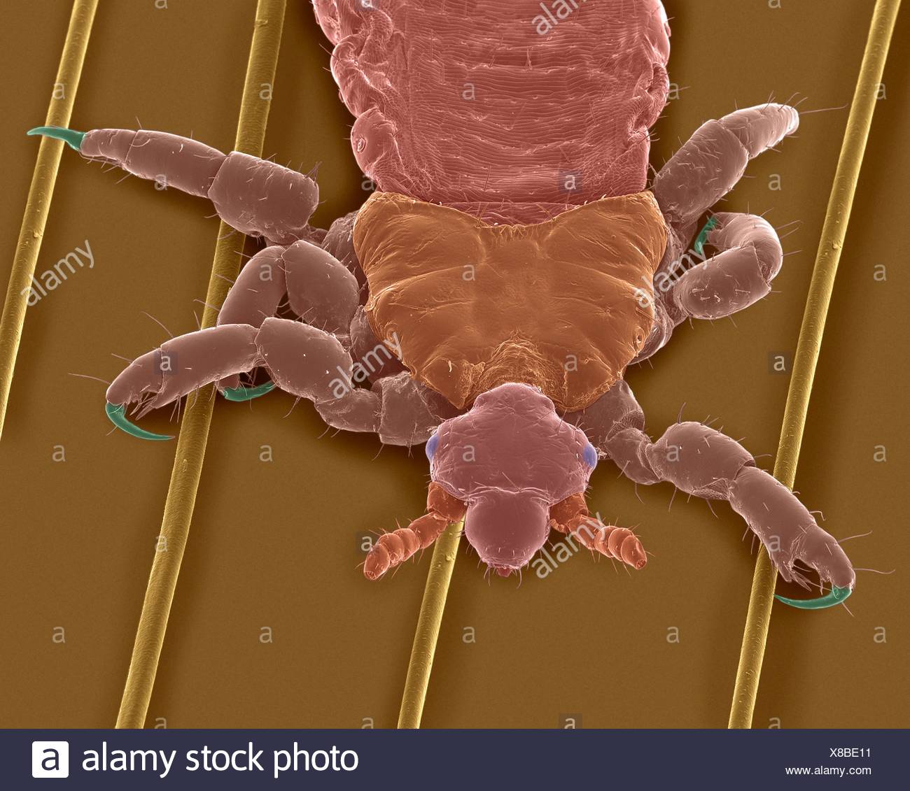 Coloured Scanning Electron Micrograph Sem Of Human Head Louse On