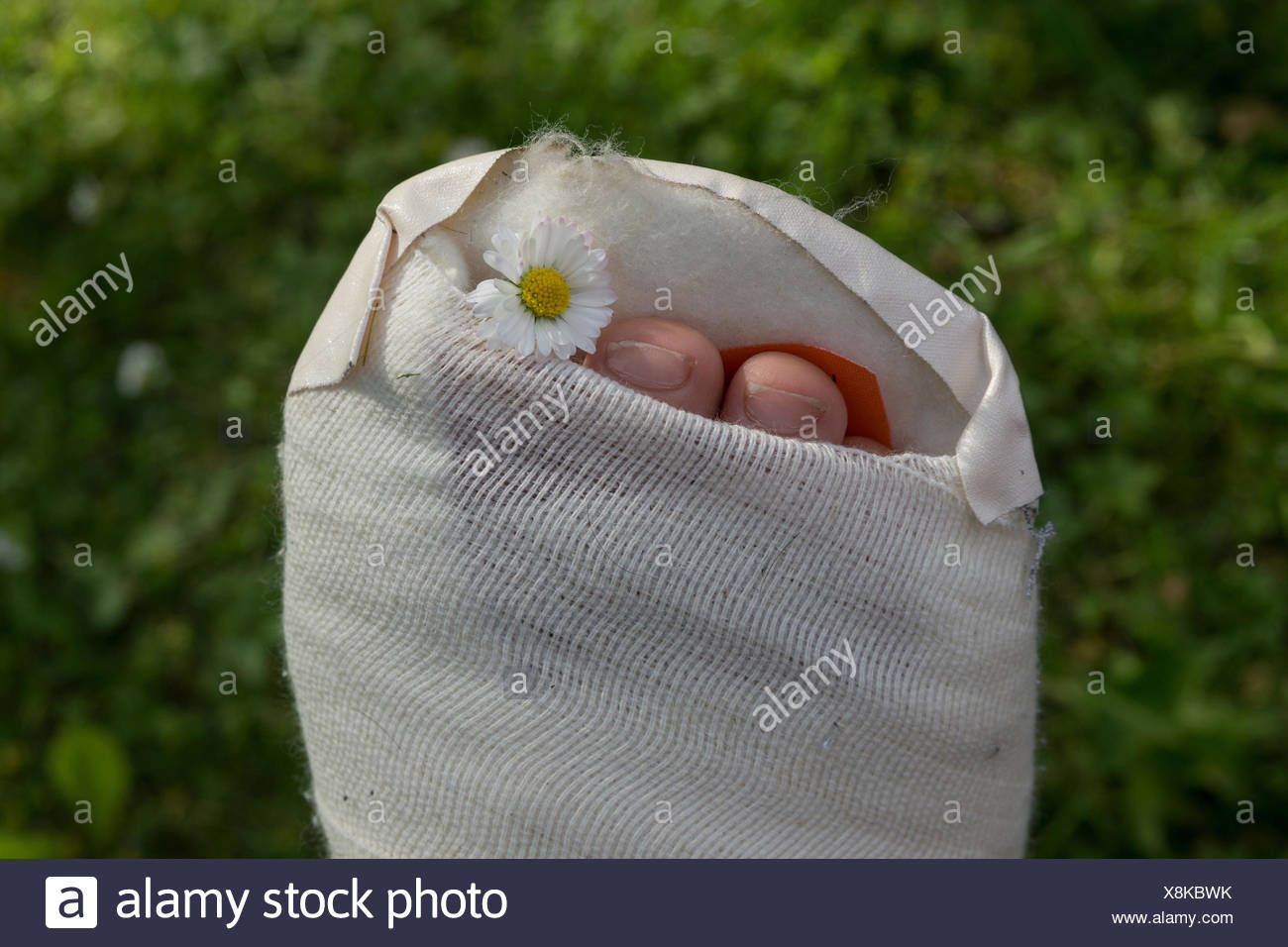 Gipsfuß eines Kindes Stock Photo